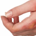 How Severe Is It? Use This Burn Degree Chart to Know Now