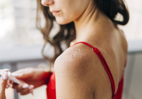 1st vs 2nd vs 3rd Degree Burns: Causes, Symptoms, and the Best Treatment Choices